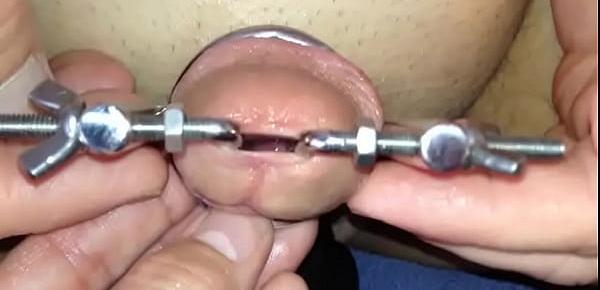  Insertion urethra, tortura de pene